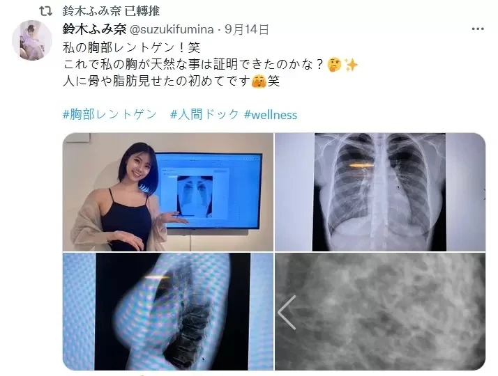 《写真偶像公开胸部X光照片》怀疑丰胸的人可以闭嘴了插图6