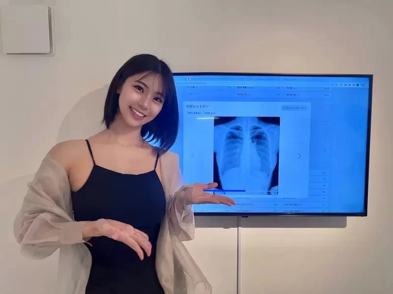 《写真偶像公开胸部X光照片》怀疑丰胸的人可以闭嘴了插图9