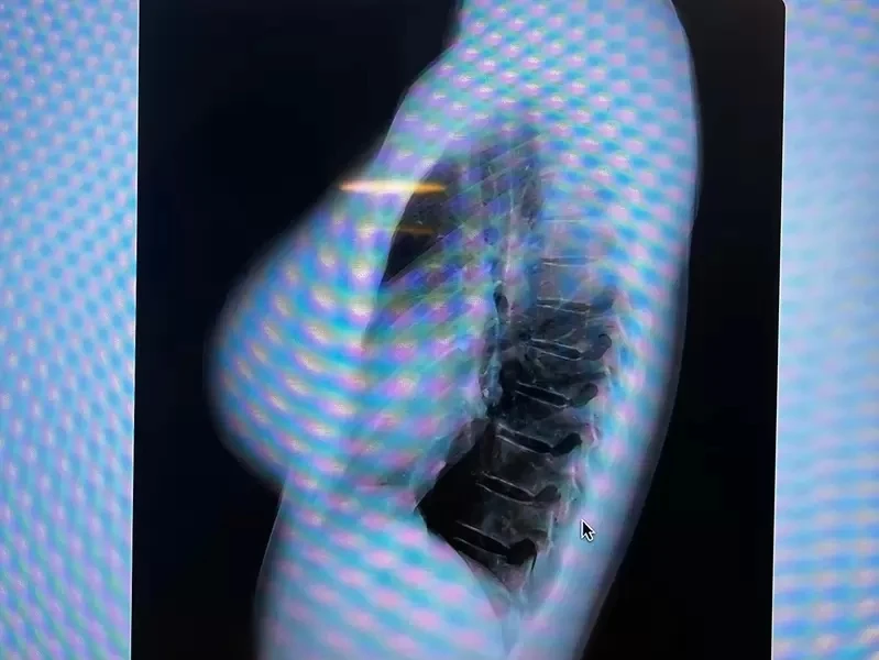 《写真偶像公开胸部X光照片》怀疑丰胸的人可以闭嘴了插图8