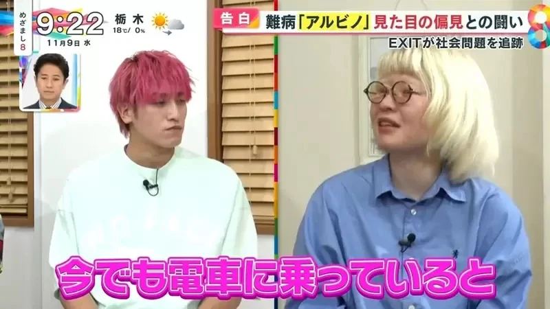 《白化症患者吐槽二次元》动漫里的白化症都是美少年美少女？害她从小总是莫名被嫌丑