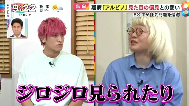 《白化症患者吐槽二次元》动漫里的白化症都是美少年美少女？害她从小总是莫名被嫌丑