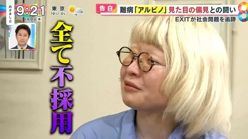 《白化症患者吐槽二次元》动漫里的白化症都是美少年美少女？害她从小总是莫名被嫌丑