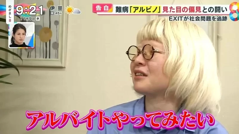 《白化症患者吐槽二次元》动漫里的白化症都是美少年美少女？害她从小总是莫名被嫌丑