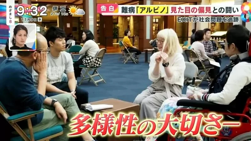 《白化症患者吐槽二次元》动漫里的白化症都是美少年美少女？害她从小总是莫名被嫌丑